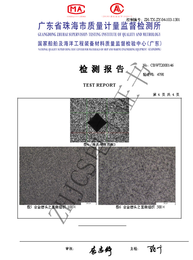 Metallographic analysis photo of standard tooth alloy